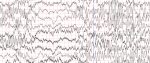An EEG reading chart
