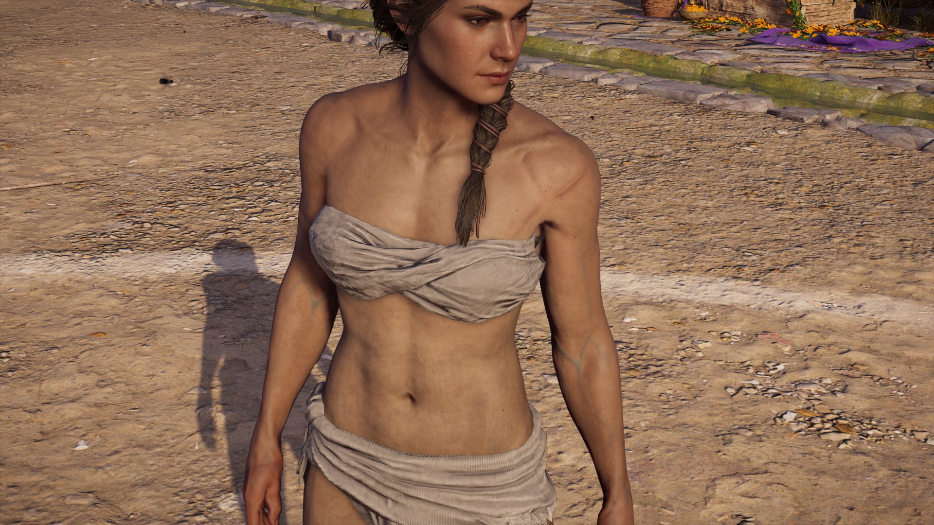 Kassandra has scars and a road map of deep blue veins running through her t...
